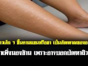จุดขาวเล็ก ๆ ขึ้นตามแขนหรือขา เป็นสัญญาณของอะไร? อย่าเพิ่งมองข้าม เพราะอาจบอกปัญหาผิวที่ค