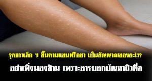 จุดขาวเล็ก ๆ ขึ้นตามแขนหรือขา เป็นสัญญาณของอะไร? อย่าเพิ่งมองข้าม เพราะอาจบอกปัญหาผิวที่ค