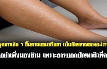 จุดขาวเล็ก ๆ ขึ้นตามแขนหรือขา เป็นสัญญาณของอะไร? อย่าเพิ่งมองข้าม เพราะอาจบอกปัญหาผิวที่ค