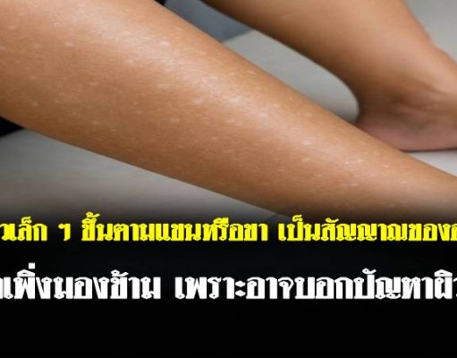 จุดขาวเล็ก ๆ ขึ้นตามแขนหรือขา เป็นสัญญาณของอะไร? อย่าเพิ่งมองข้าม เพราะอาจบอกปัญหาผิวที่ค