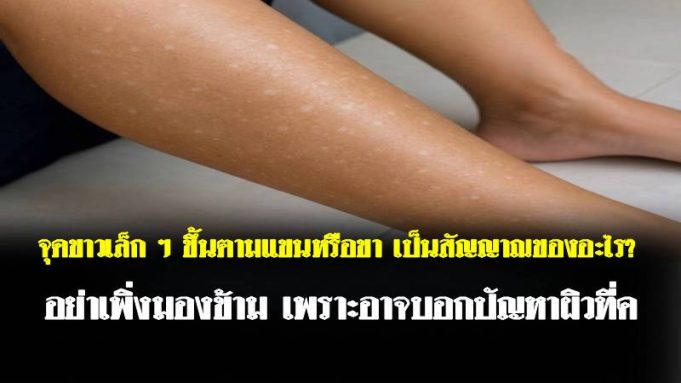 จุดขาวเล็ก ๆ ขึ้นตามแขนหรือขา เป็นสัญญาณของอะไร? อย่าเพิ่งมองข้าม เพราะอาจบอกปัญหาผิวที่ค