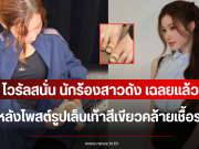 ไวรัลสนั่น นักร้องสาวดัง เฉลยแล้ว หลังโพสต์รูปเล็บเท้าสีเขียวคล้ายเชื้อรา (ตปท.)