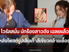 ไวรัลสนั่น นักร้องสาวดัง เฉลยแล้ว หลังโพสต์รูปเล็บเท้าสีเขียวคล้ายเชื้อรา (ตปท.)