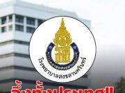 โรงพยาบาลสงขลานครินทร์ ออกประกาศแจ้งถึงผู้ป่วย