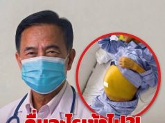 ไม่ใช่เหล้า! หญิงนอนตัวเหลือง “ตับแข็งเหมือนหิน” เซ่นน้ำที่ดื่มเข้าไป แพทย์ชี้เสี่ยงตายสูง