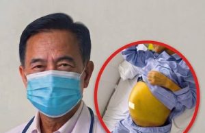 ไม่ใช่เหล้า! หญิงนอนตัวเหลือง “ตับแข็งเหมือนหิน” เซ่นน้ำที่ดื่มเข้าไป แพทย์ชี้เสี่ยงตายสูง
