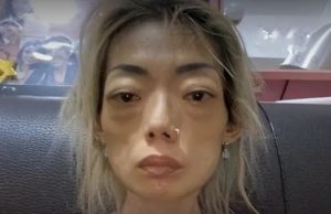 บทเรียนราคาแพง อดีตนางแบบดัง ซูบเหลือเพียง 22 กก. จากคำพูดเปลี่ยนชีวิตของสามี (ต่างประเทศ)