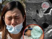 แม่ช็อก! เห็นท้องลูกสาว ม.3 โตผิดปกติ พาไปหาหมอ ได้ยินคำตอบแทบทรุด