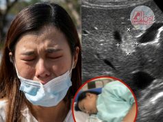 แม่ช็อก! เห็นท้องลูกสาว ม.3 โตผิดปกติ พาไปหาหมอ ได้ยินคำตอบแทบทรุด