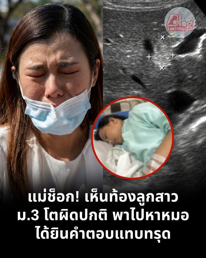 แม่ช็อก! เห็นท้องลูกสาว ม.3 โตผิดปกติ พาไปหาหมอ ได้ยินคำตอบแทบทรุด