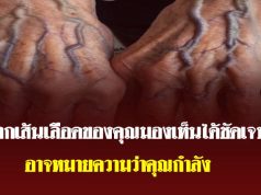 เส้นเลือดที่มือชัดขึ้น บอกอะไรเกี่ยวกับสุขภาพของคุณ