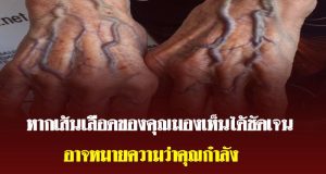 เส้นเลือดที่มือชัดขึ้น บอกอะไรเกี่ยวกับสุขภาพของคุณ