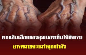 เส้นเลือดที่มือชัดขึ้น บอกอะไรเกี่ยวกับสุขภาพของคุณ
