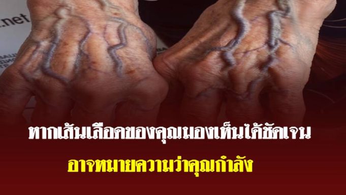 เส้นเลือดที่มือชัดขึ้น บอกอะไรเกี่ยวกับสุขภาพของคุณ