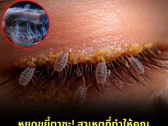 หยุดขยี้ตาซะ! สาเหตุที่ทำให้คุณคันตาในทุกเช้านั้น เป็นเรื่องที่ ‘น่ากลัว’ อย่างนี้เอง