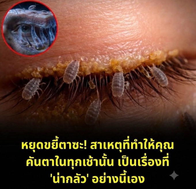 หยุดขยี้ตาซะ! สาเหตุที่ทำให้คุณคันตาในทุกเช้านั้น เป็นเรื่องที่ ‘น่ากลัว’ อย่างนี้เอง