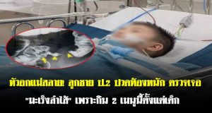 หัวอกแม่สลาย! ลูกชาย ป.2 ปวดท้องหนัก ตรวจเจอ “มะเร็งลำไส้” เพราะกิน 2 เมนูนี้ตั้งแต่เด็ก
