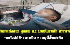 หัวอกแม่สลาย! ลูกชาย ป.2 ปวดท้องหนัก ตรวจเจอ “มะเร็งลำไส้” เพราะกิน 2 เมนูนี้ตั้งแต่เด็ก