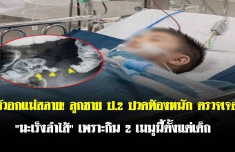 หัวอกแม่สลาย! ลูกชาย ป.2 ปวดท้องหนัก ตรวจเจอ “มะเร็งลำไส้” เพราะกิน 2 เมนูนี้ตั้งแต่เด็ก