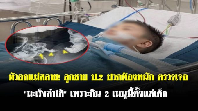 หัวอกแม่สลาย! ลูกชาย ป.2 ปวดท้องหนัก ตรวจเจอ “มะเร็งลำไส้” เพราะกิน 2 เมนูนี้ตั้งแต่เด็ก