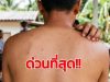 เตือน ใครมีอาการดังนี้ แล้ว “รักษาไม่หาย” ไปตรวจด่วน ระวัง HIV