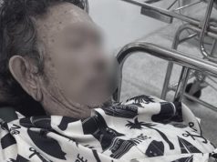 รพ.มุกดาหาร แจงแล้ว ชายวัย 65 ปวดท้องหนักจนเสียชีวิต รอรักษา 4 ชม.