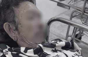 รพ.มุกดาหาร แจงแล้ว ชายวัย 65 ปวดท้องหนักจนเสียชีวิต รอรักษา 4 ชม.