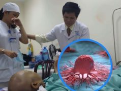 5 จุดปวดบนร่างกายที่เตือนมะ.เร็.งระยะเริ่มต้น: อย่าชะล่าใจ รีบไปตรวจทันที