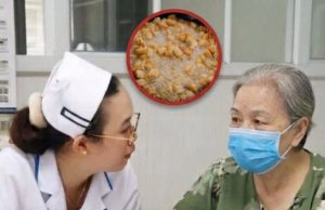 หญิงวัย 57 ปี ใช้มันหมูทำอาหารนาน 3 ปี พอไปตรวจร่างกาย หมอถึงกับตกใจถาม “คุณไปทำอะไรมา?”