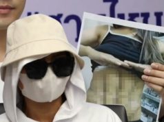 ดูดไขมันสยอง สาว 36 ทำร่อง 11 คลินิกดัง กลายเป็นฝันร้ายตลอดชีวิต