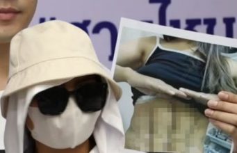 ดูดไขมันสยอง สาว 36 ทำร่อง 11 คลินิกดัง กลายเป็นฝันร้ายตลอดชีวิต
