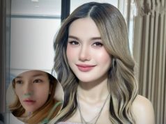 น่าเป็นห่วงมาก! เผยอาการ ฟารีดา ไหทองคำ ล่าสุด หลังแอดมิต