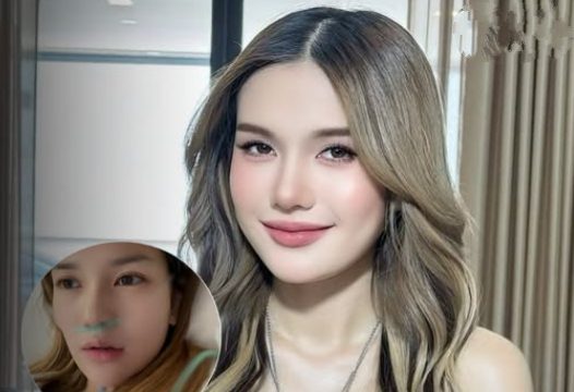 น่าเป็นห่วงมาก! เผยอาการ ฟารีดา ไหทองคำ ล่าสุด หลังแอดมิต