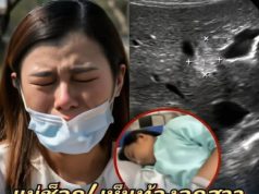 แม่ช็อก! เห็นท้องลูกสาว ม.3 โตผิดปกติ พาไปหาหมอ ได้ยินคำตอบแทบทรุด