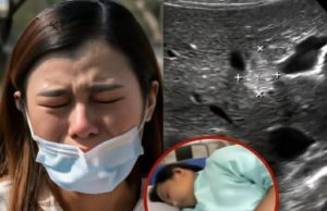 แม่ช็อก! เห็นท้องลูกสาว ม.3 โตผิดปกติ พาไปหาหมอ ได้ยินคำตอบแทบทรุด