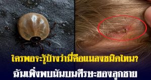 ใครพอจะรู้บ้างว่านี่คือแมลงชนิดไหน? ฉันเพิ่งพบมันบนศีรษะของลูกชาย…