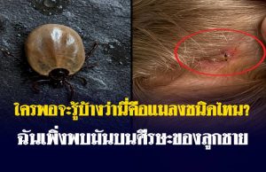 ใครพอจะรู้บ้างว่านี่คือแมลงชนิดไหน? ฉันเพิ่งพบมันบนศีรษะของลูกชาย…