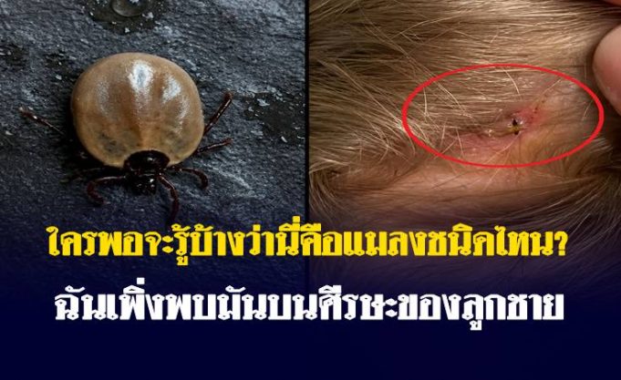 ใครพอจะรู้บ้างว่านี่คือแมลงชนิดไหน? ฉันเพิ่งพบมันบนศีรษะของลูกชาย…