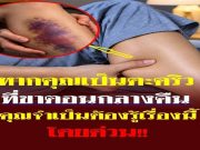 คุณเป็นตะคริวกลางดึกบ่อยหรือไม่? อาการนี้อาจกำลังบอกบางอย่างเกี่ยวกับสุขภาพที่คุณไม่คว
