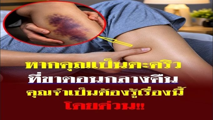 คุณเป็นตะคริวกลางดึกบ่อยหรือไม่? อาการนี้อาจกำลังบอกบางอย่างเกี่ยวกับสุขภาพที่คุณไม่คว