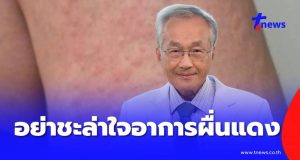 อย่าชะล่าใจ เปิดอาการผื่นแดงตามตัว ก่อนหมอตรวจเจอ ซิฟิลิสระยะ 2