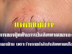 ขนคางของผู้หญิงอาจเป็นสัญญาณของอะไร? อย่ามองข้าม เพราะร่างกายกำลังส่งสัญญาณเตือน