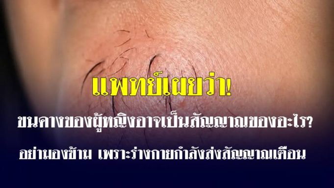ขนคางของผู้หญิงอาจเป็นสัญญาณของอะไร? อย่ามองข้าม เพราะร่างกายกำลังส่งสัญญาณเตือน