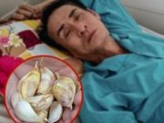 ชายวัย 58 ปี กินกระเทียมสดทุกเช้า 2 ปี หวังสกัดมะเ.ร็ง พอไปตรวจสุขภาพ หมอถึงกับถาม “คุณทำอะไรมา?”