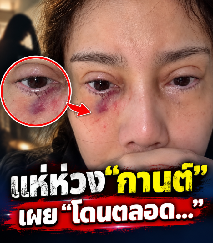 เกิดอะไรขึ้น “กานต์ ภรรยา เสก โลโซ” โพสต์รูปล่าสุด คนแห่ห่วงสนั่น