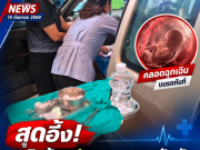 สุดอั้น! หญิงท้องปวดกะทันหัน มาถึง รพ. ศีรษะลูกโผล่แล้ว ทนไม่ไหวคลอดบนรถทันที