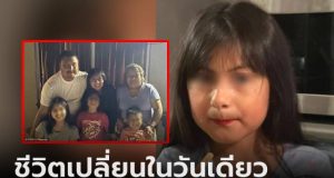 ช็อกมาก! เด็ก 7 ขวบ จู่ๆ ตื่นมาป่วยตัวม่วง หมอต้องตัดมือ-เท้า เผยเชื้อนี้ใครก็ติดได้