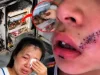 ลูกชายร้องลั่น เย็บหน้า 38 เข็ม แค่เพราะหยิบ “สิ่งนี้” จากช่องฟรีซ เตือนแช่ไว้แทบทุกบ้าน!!!