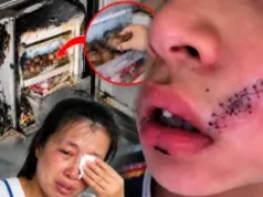ลูกชายร้องลั่น เย็บหน้า 38 เข็ม แค่เพราะหยิบ “สิ่งนี้” จากช่องฟรีซ เตือนแช่ไว้แทบทุกบ้าน!!!