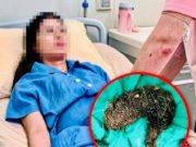 เด็กหญิงวัย 14 ปีปวดท้องต่อเนื่องหลายเดือน ก่อนแพทย์พบสาเหตุที่หลายครอบครัวควรรู้